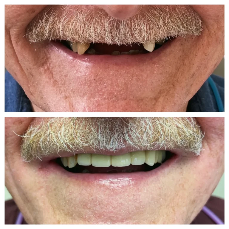 562.168_9144_img_4581