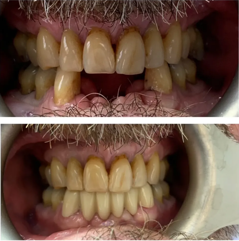 562.1687_5489_img_4556