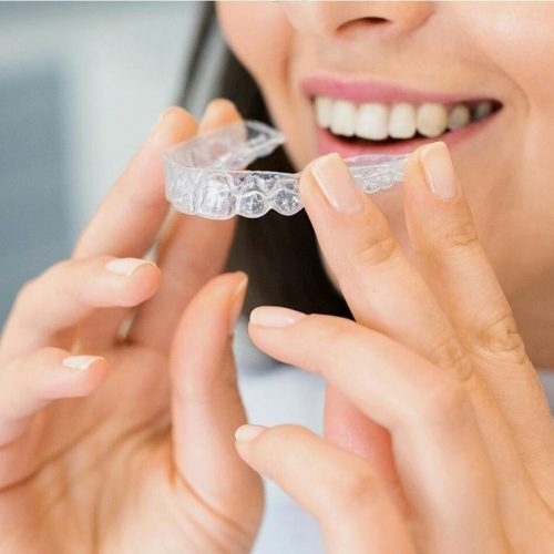 Close-up of a woman holding a clear dental aligner, showcasing dental health and a bright smile.