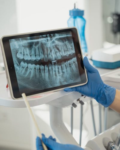 A Patient Dental X-ray on a Tablet Screen