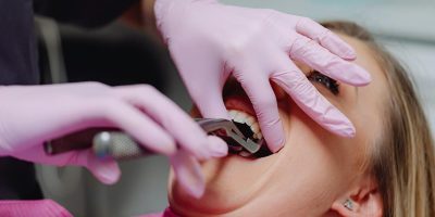 A Patient Undergoing a Dental Procedure